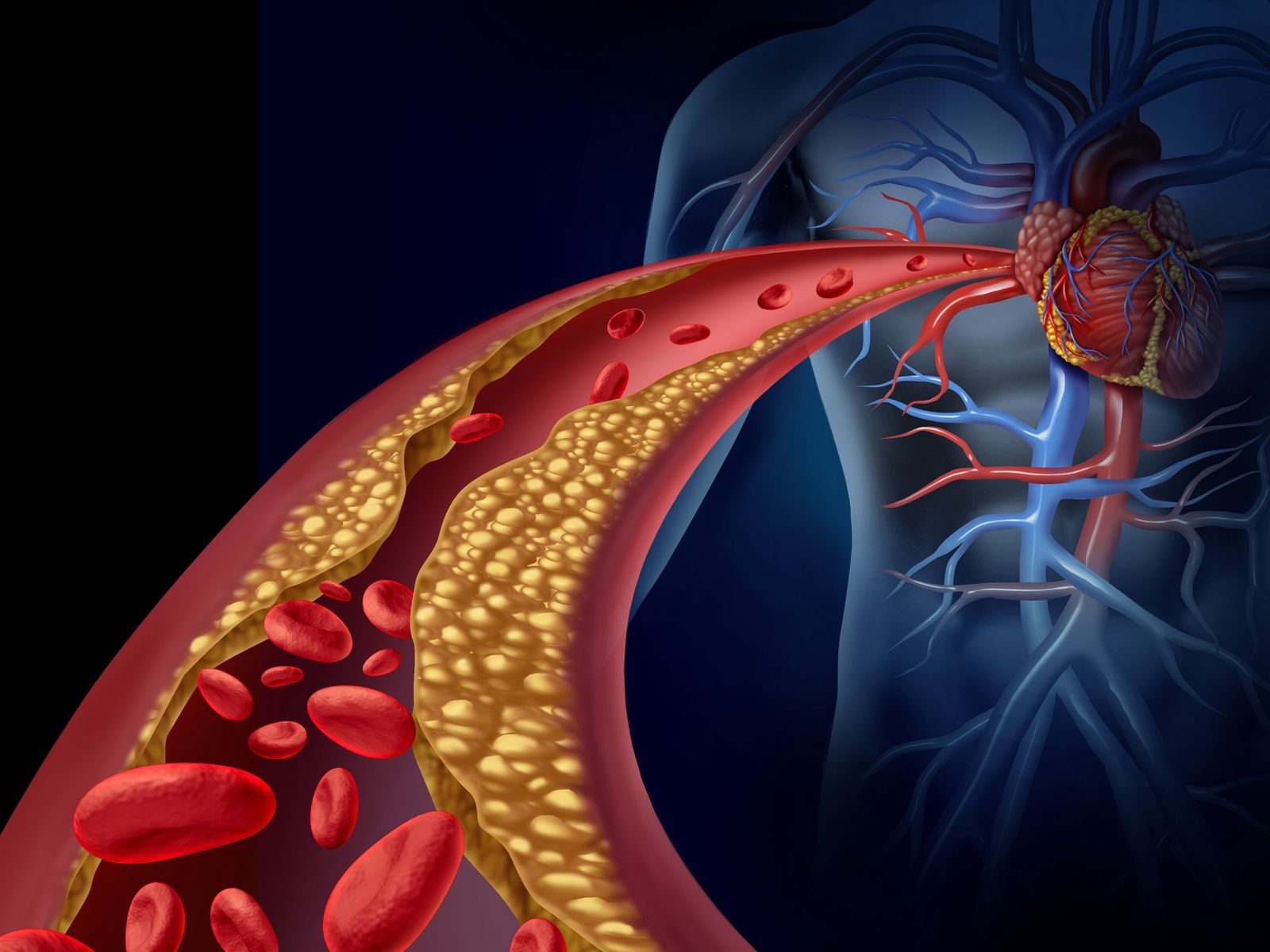 Udhëzimi i Ri i ACC/AHA për Menaxhimin e Dislipidemisë